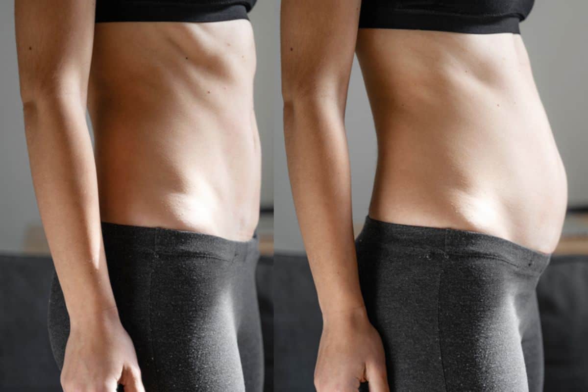 How long does diastasis recti take to improve Brierley Hill?