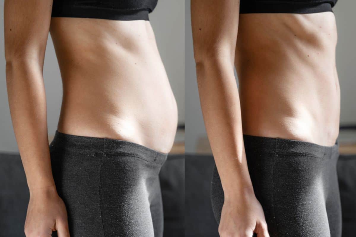 Post-Pregnancy: What Happens to Your Abdominal Muscles After Birth Brierley Hill