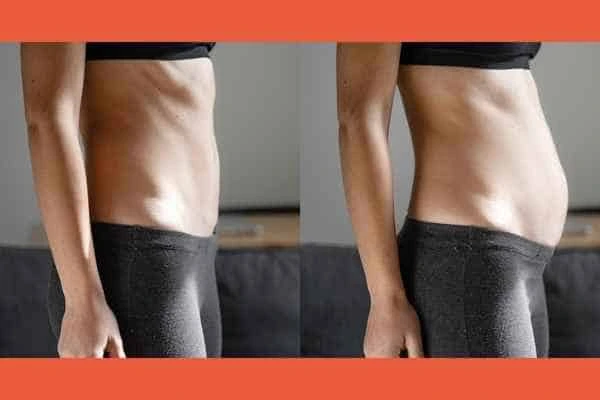 LA-EMS Body Sculpting results Brierley Hill