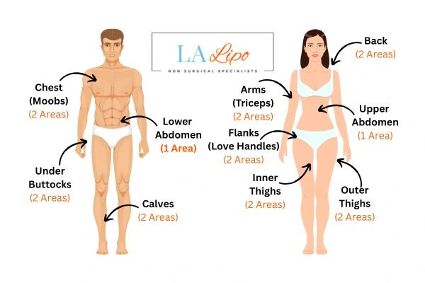 LA LIPO Cryolipolysis Areas Brierley Hill