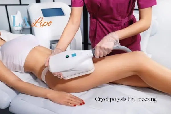 Woman receiving coolsculpting Brierley Hill treatment on her thighs