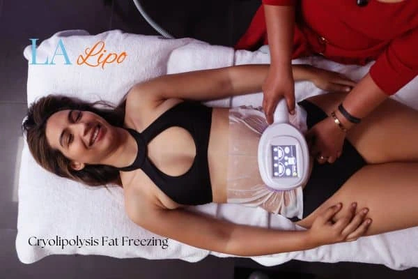 woman getting cryolipolysis Brierley Hill