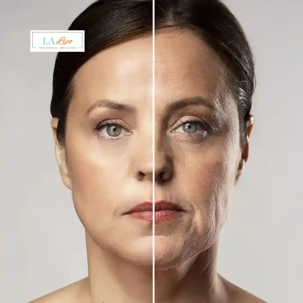 How Can You Tell If Non-Surgical Skin Tightening Is Right for You Brierley Hill?