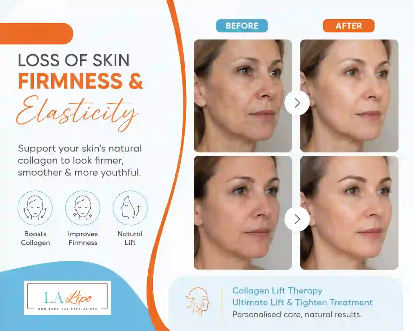 Sign #7: Loss of Skin Firmness and Elasticity Brierley Hill